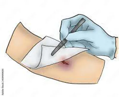 پانسمان در منزل اصفهان