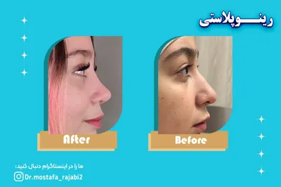بهترین چراح زیبایی بینی در اصفهان