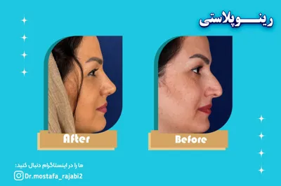 متخصص جراحی زیبایی بینی در استان اصفهان