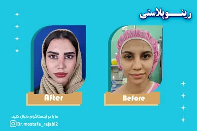بهترین متخصص جراحی بینی در اصفهان