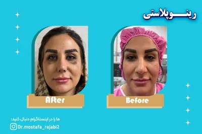 بهترین چراح زیبایی بینی در اصفهان