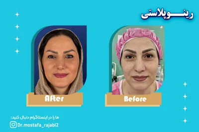 متخصص جراحی زیبایی بینی در استان اصفهان