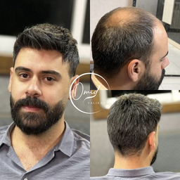 کلینیک پروتز مو
