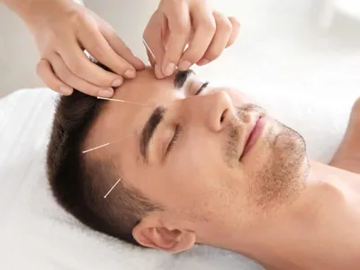 طب سوزنی صورت