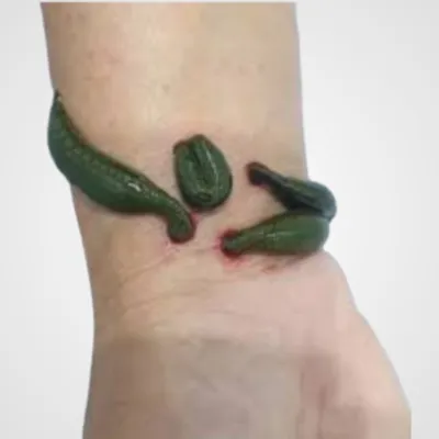 زالو مچ دست