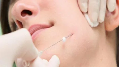 امبدینگ صورت