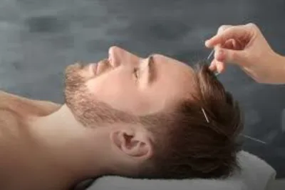 طب سوزنی سر