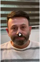 پروتز مو مردانه در پرند