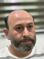 پروتز مو مردانه در پرند