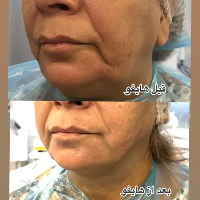 کلینیک زیبایی نهال 