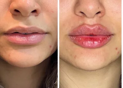 لب روسی کاملا طبیعی