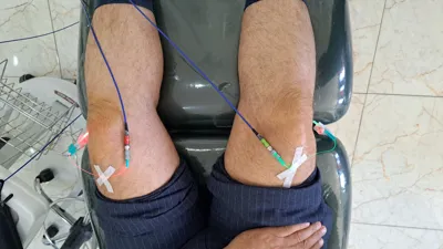 تزریق عصاره جفت در اصفهان