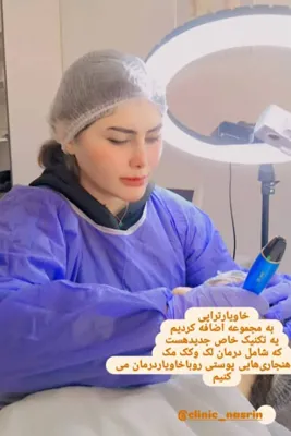 کلینیک تخصصی درمان منافذ باز پوست شیراز