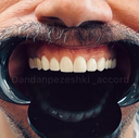 دندانپزشکی آکورد در اصفهان