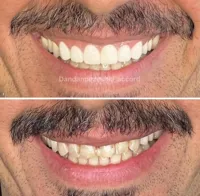 دندانپزشکی آکورد در اصفهان 