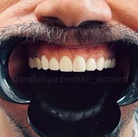 دندانپزشکی آکورد در اصفهان 