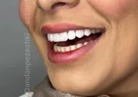 دندانپزشکی آکورد در اصفهان 