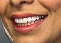 دندانپزشکی آکورد در اصفهان 