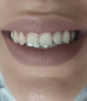 دندانپزشکی آکورد در اصفهان 