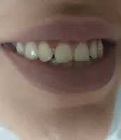 دندانپزشکی آکورد در اصفهان 