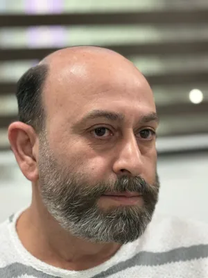 فر مو مردانه در پرند