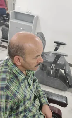 فر مو مردانه در پرند