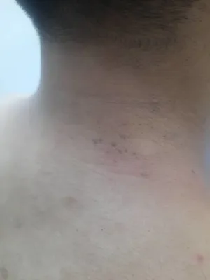 لیزرکیوسوییچ هشتگرد