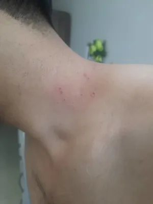 درمان ضایعه پوستی