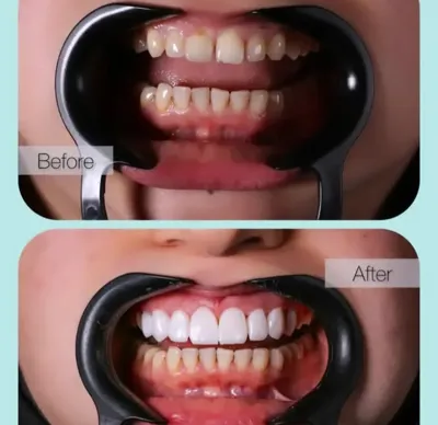 کیلینیک دندانپزشکی معتبر در شریعتی تهران 