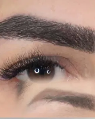 کاشت ابروباجراحی