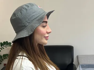 قبل و بعد جراحی بینی در اصفهان