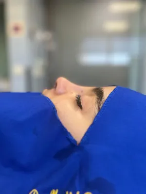 جراح زیبایی بینی در اصفهان