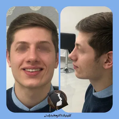 بهترین دکتر بینی در اصفهان