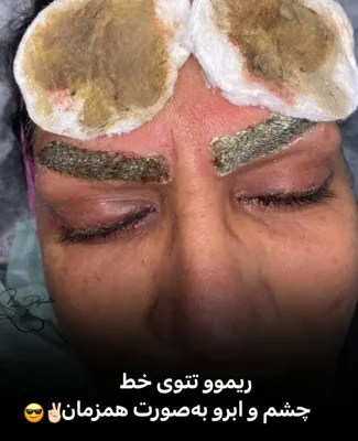 بهترین خدمات آرایش دائم در کرمان 
