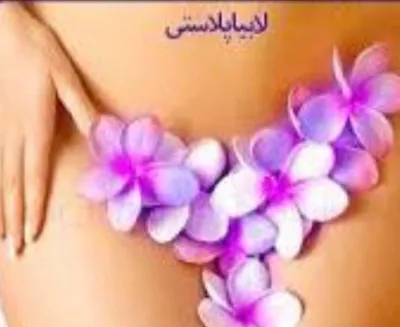 بازسازی پرده بکارت در خرم آباد