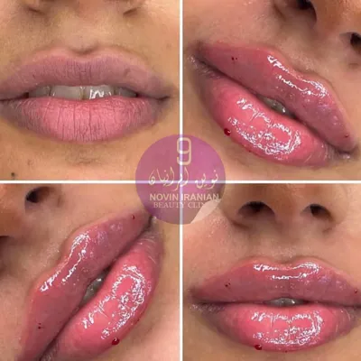 کلینیک زیبایی در گوهردشت