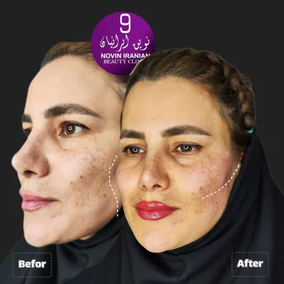 بهترین کلینک زیبایی در گوهردشت