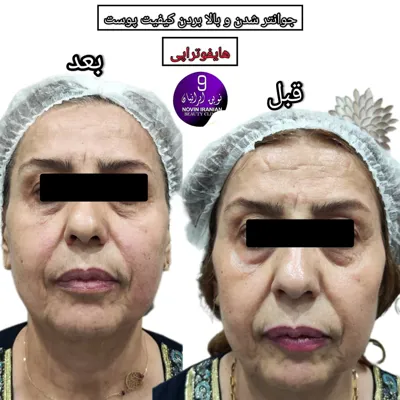 بهترین کلینیک زیبایی در مهرشهر