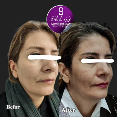 کلینیک زیبایی در گوهردشت