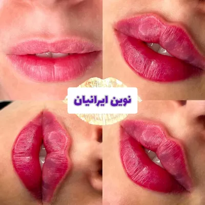 بهترین کلینیک زیبایی در مهرشهر