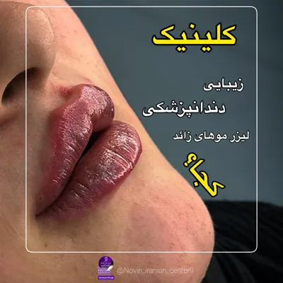 کلینیک زیبایی در گوهردشت
