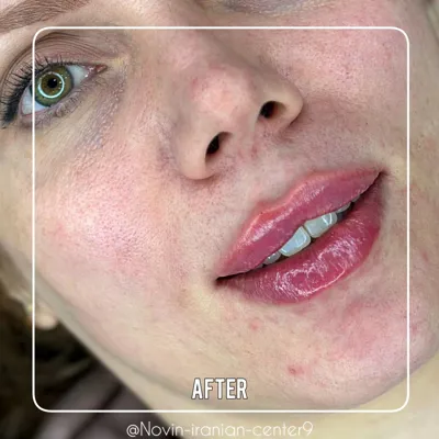 کلینیک زیبایی در گوهردشت