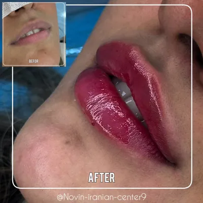 کلینیک زیبایی در مهرشهر