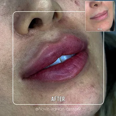 بهترین کلینیک زیبایی در مهرشهر