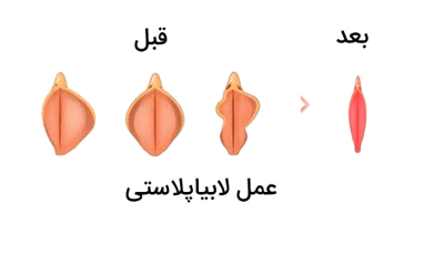 کلینیک لابیا پلاستی در خرم آباد