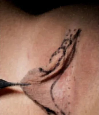 اموزش مراقبت های ویژه در خرم اباد