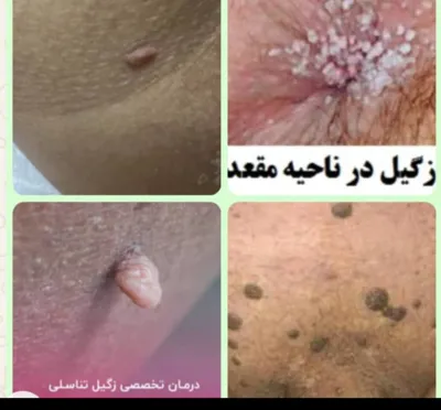 نوبت حاملگیخرم اباد