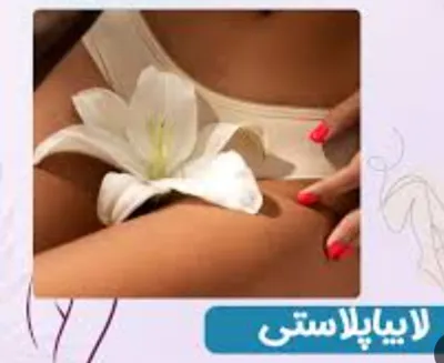 لابیاپلاستی در خرم اباد