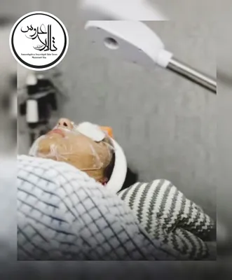 پاکسازی پوست در کرمان؛ تالار عروس منصوری نیا