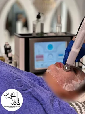 پاکسازی پوست در کرمان/ تالار عروس منصوری نیا